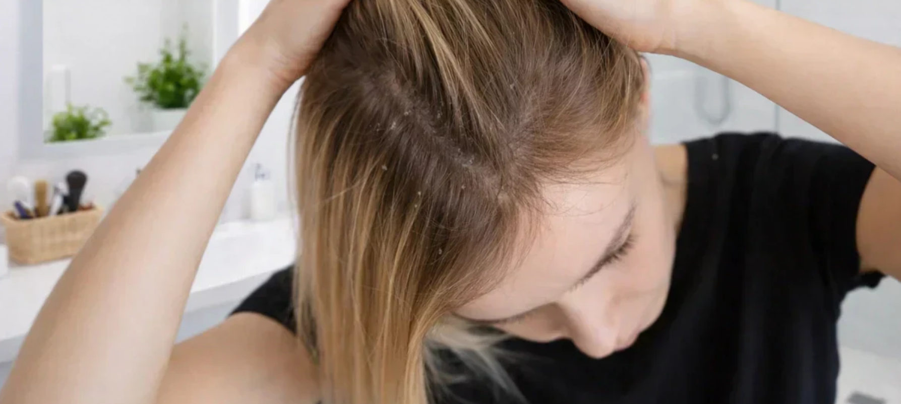 7 consigli per scegliere lo shampoo purificante antiforfora migliore per i tuoi capelli